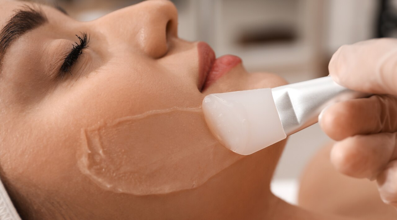 Chemical Peels