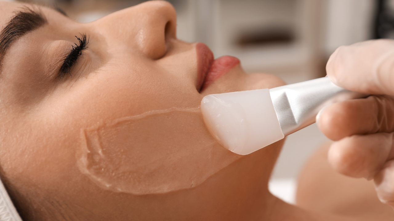 Chemical Peels