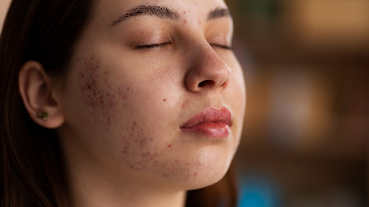 Textured Skin Causes You Should Know image