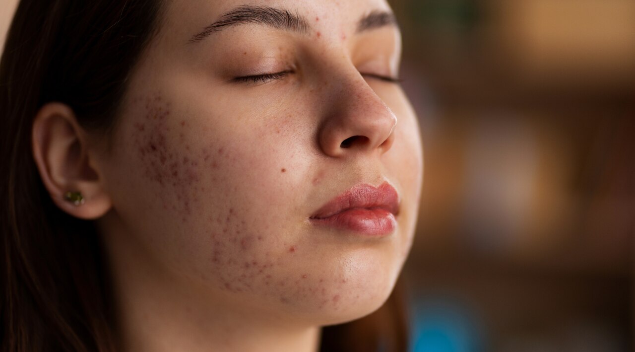 Textured Skin Causes You Should Know image