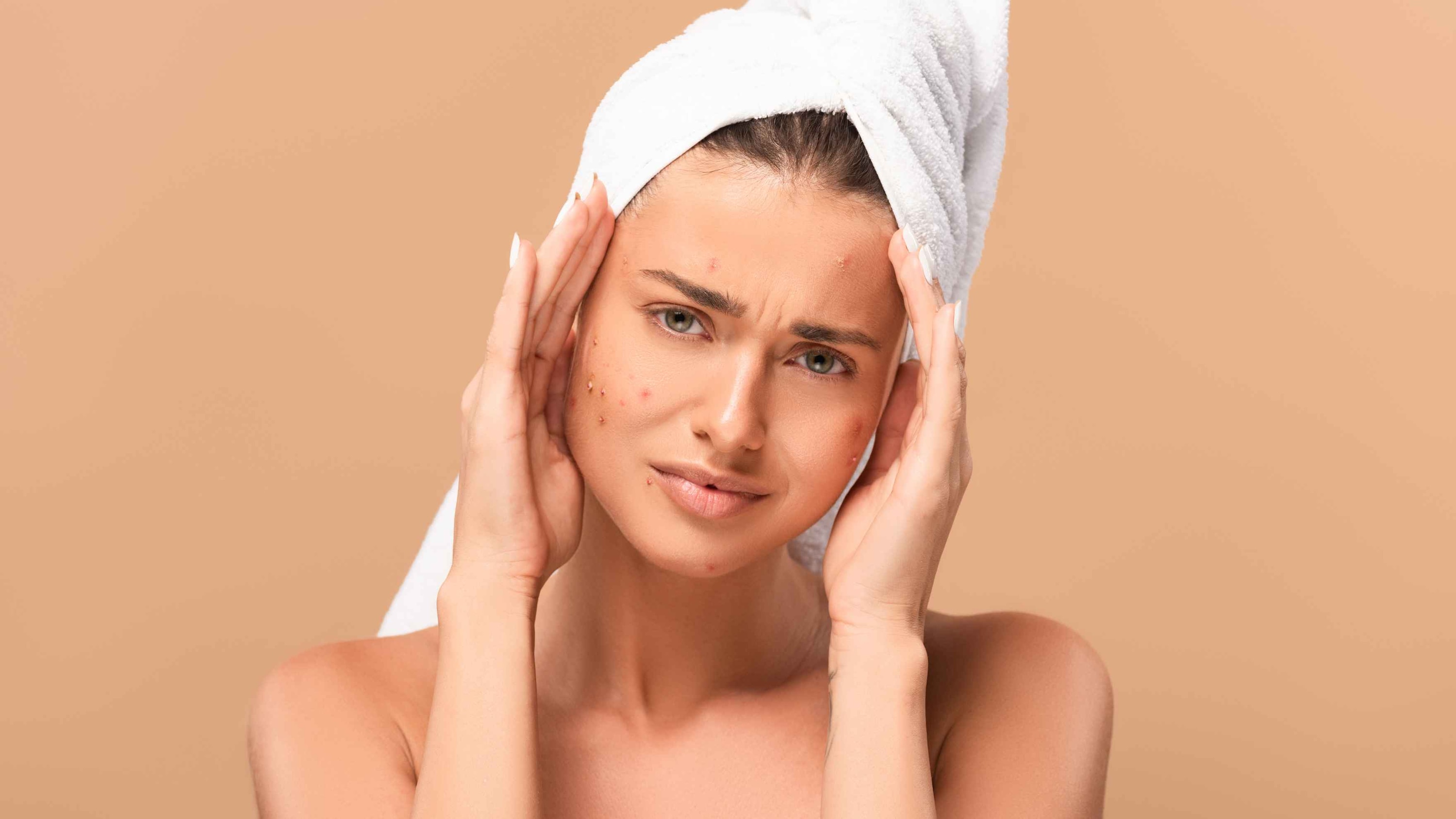 Types of Blemishes on Face