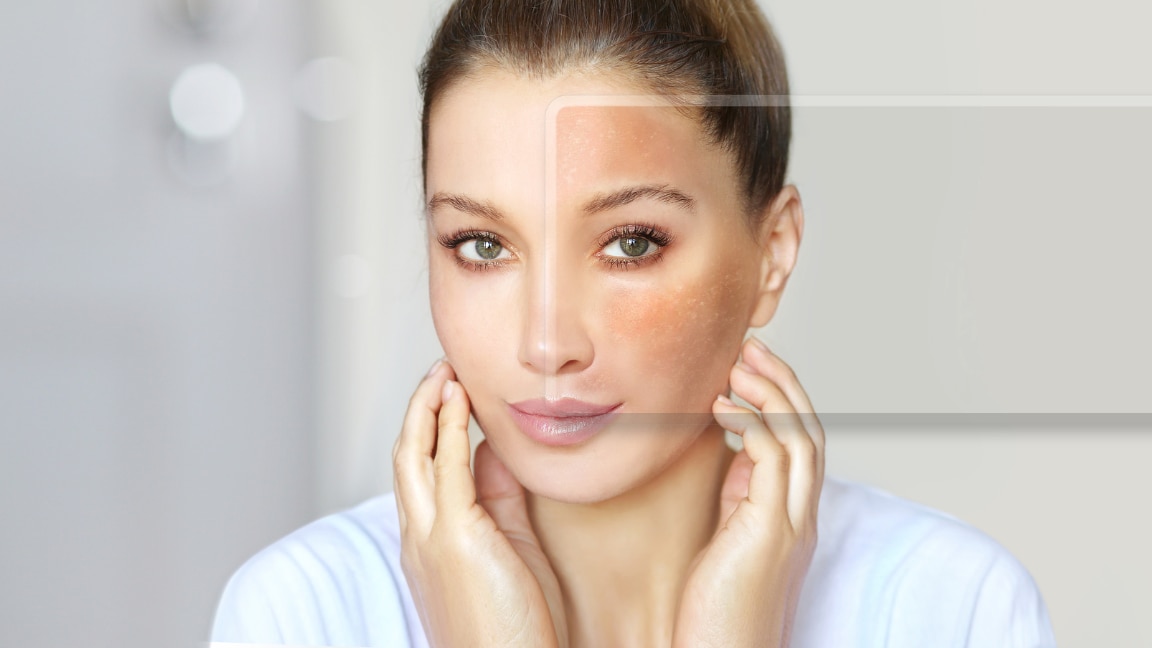 How to Fix Uneven Skin Texture: Proven Causes & Treatments That Work