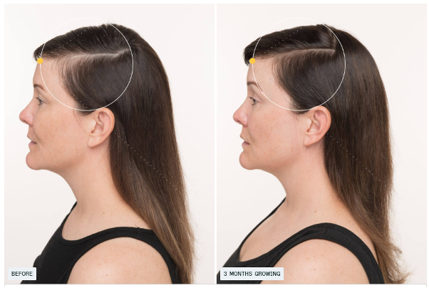 before / after image 