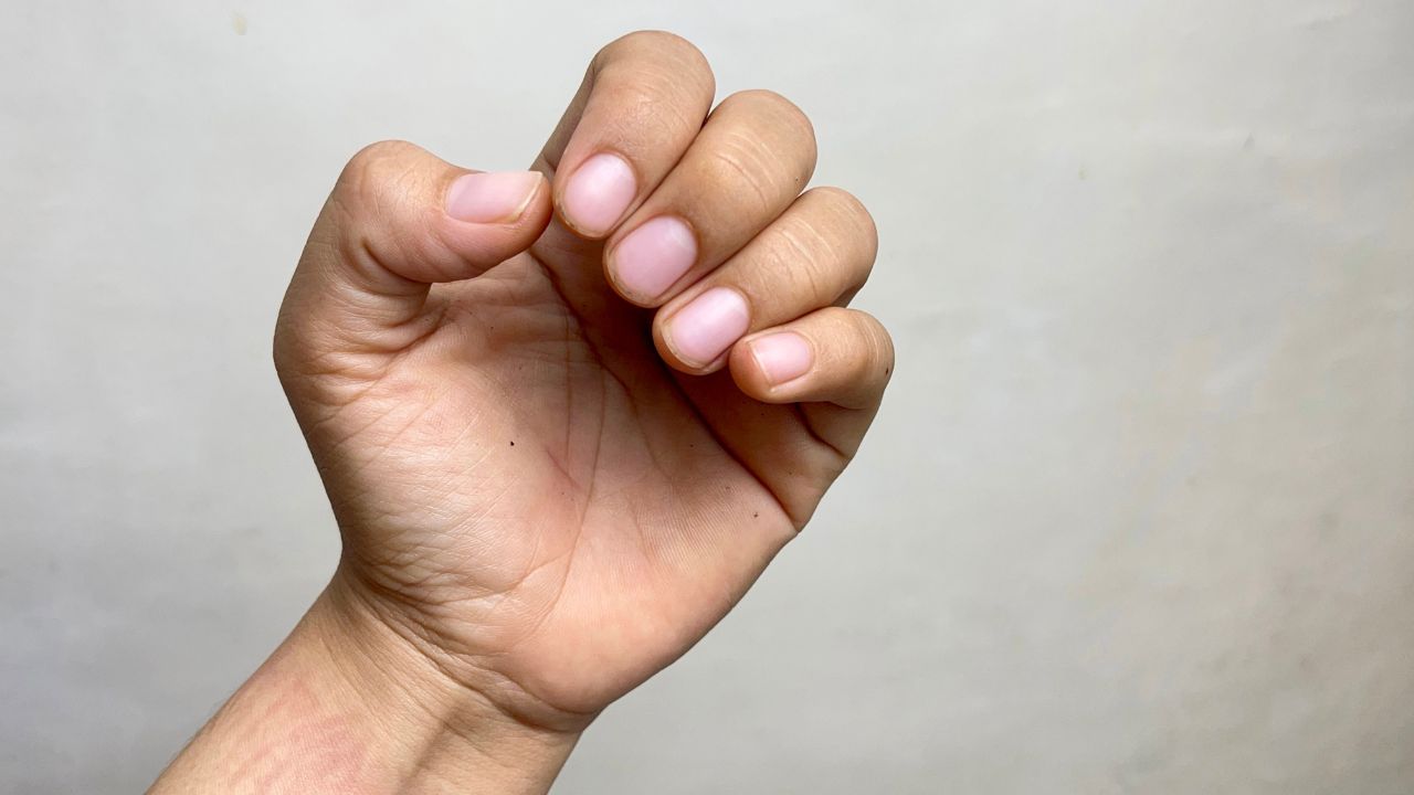 Causes of Slow Nail Growth Image