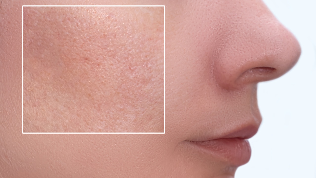 Reduces Pores