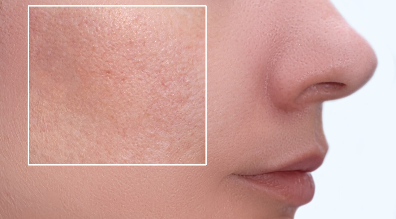 Reduces Pores