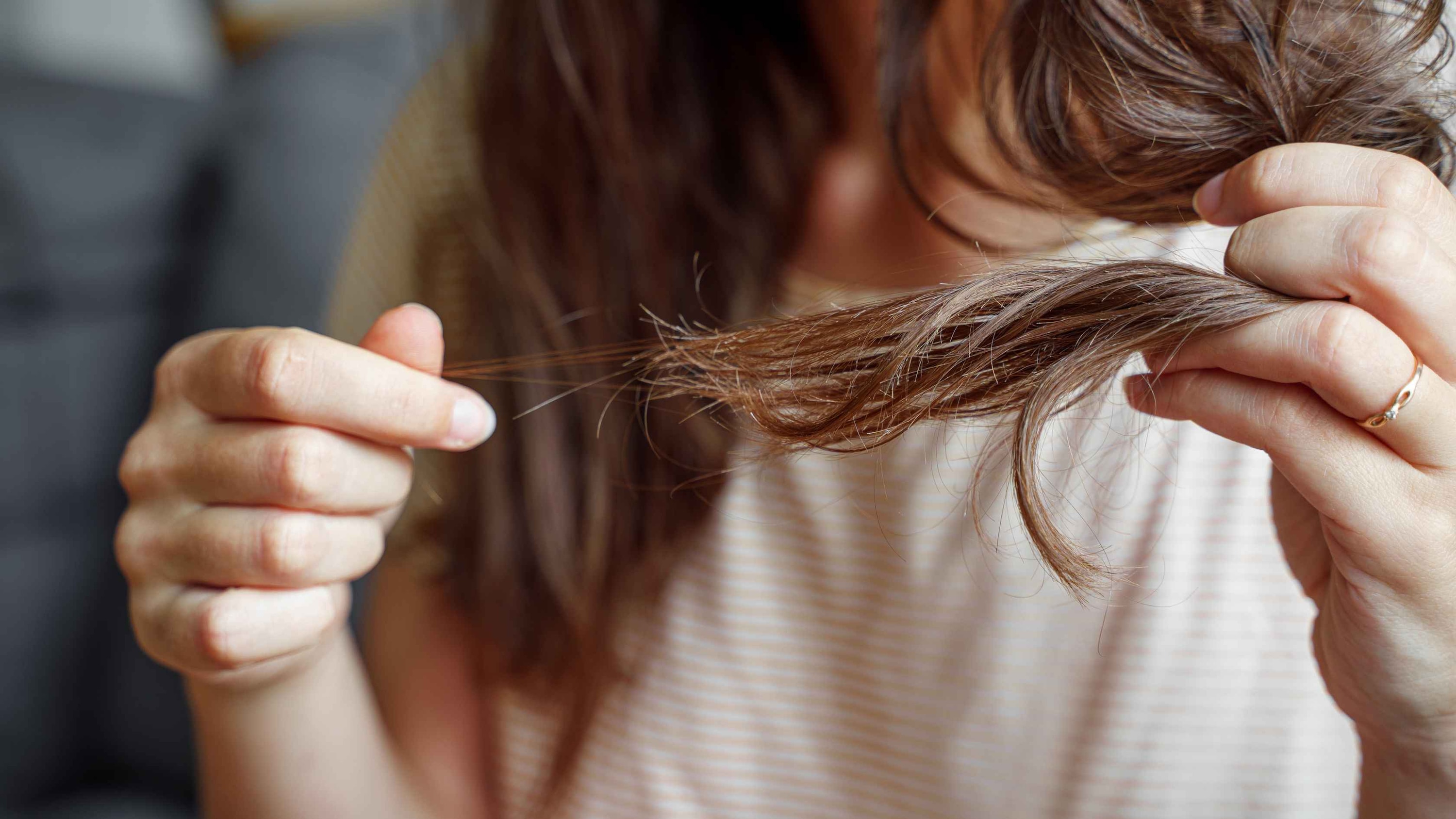 Benefits of Yoga for Hair Fall