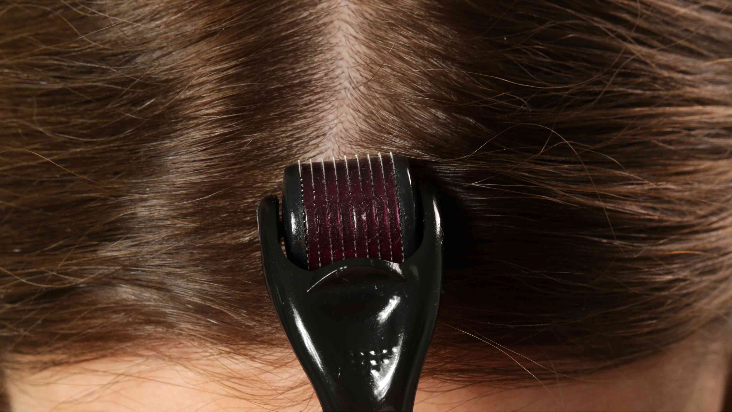 Best Derma Roller for Hair Growth: What to Look For Image