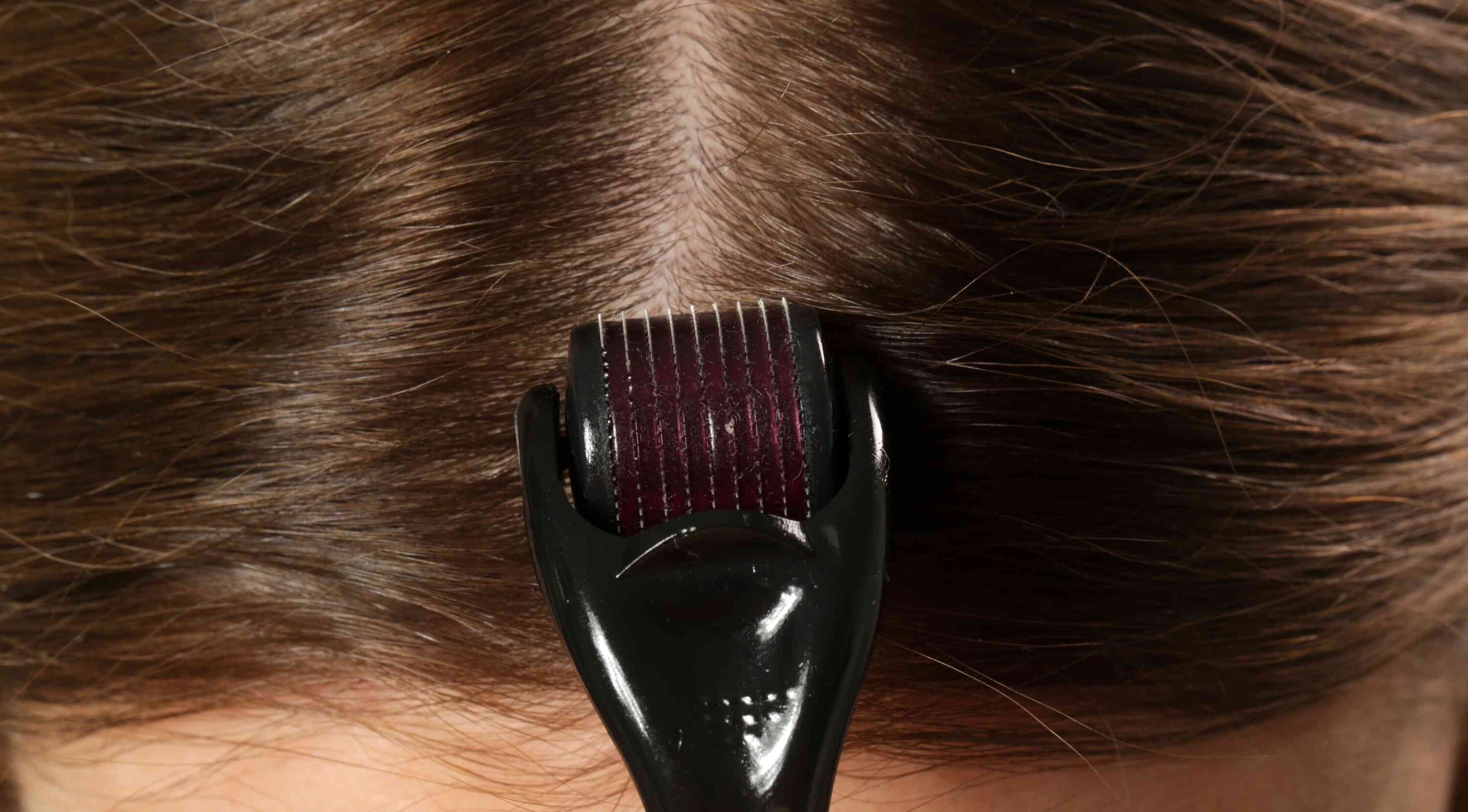 Best Derma Roller for Hair Growth: What to Look For Image