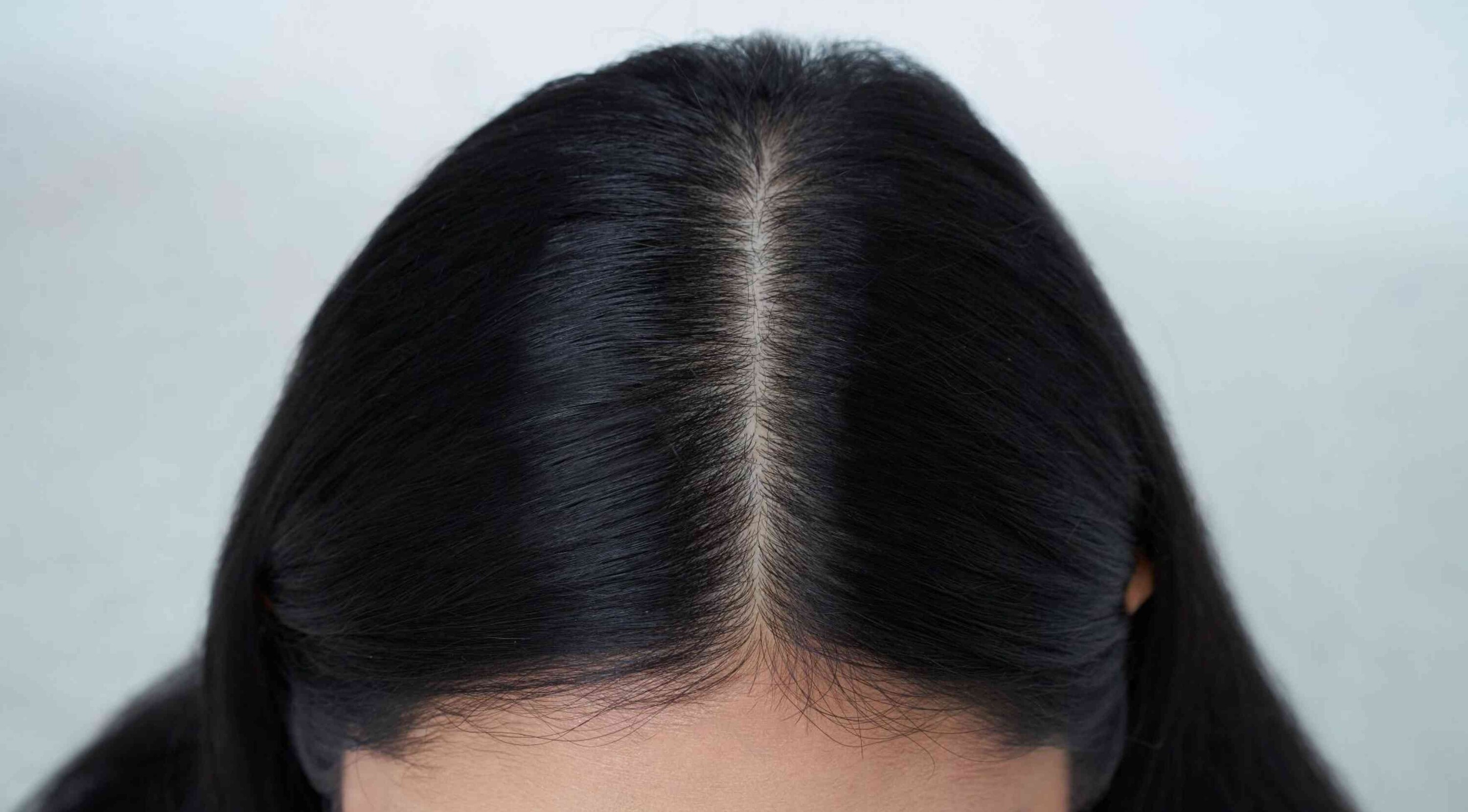 Start with a Clean Scalp Image
