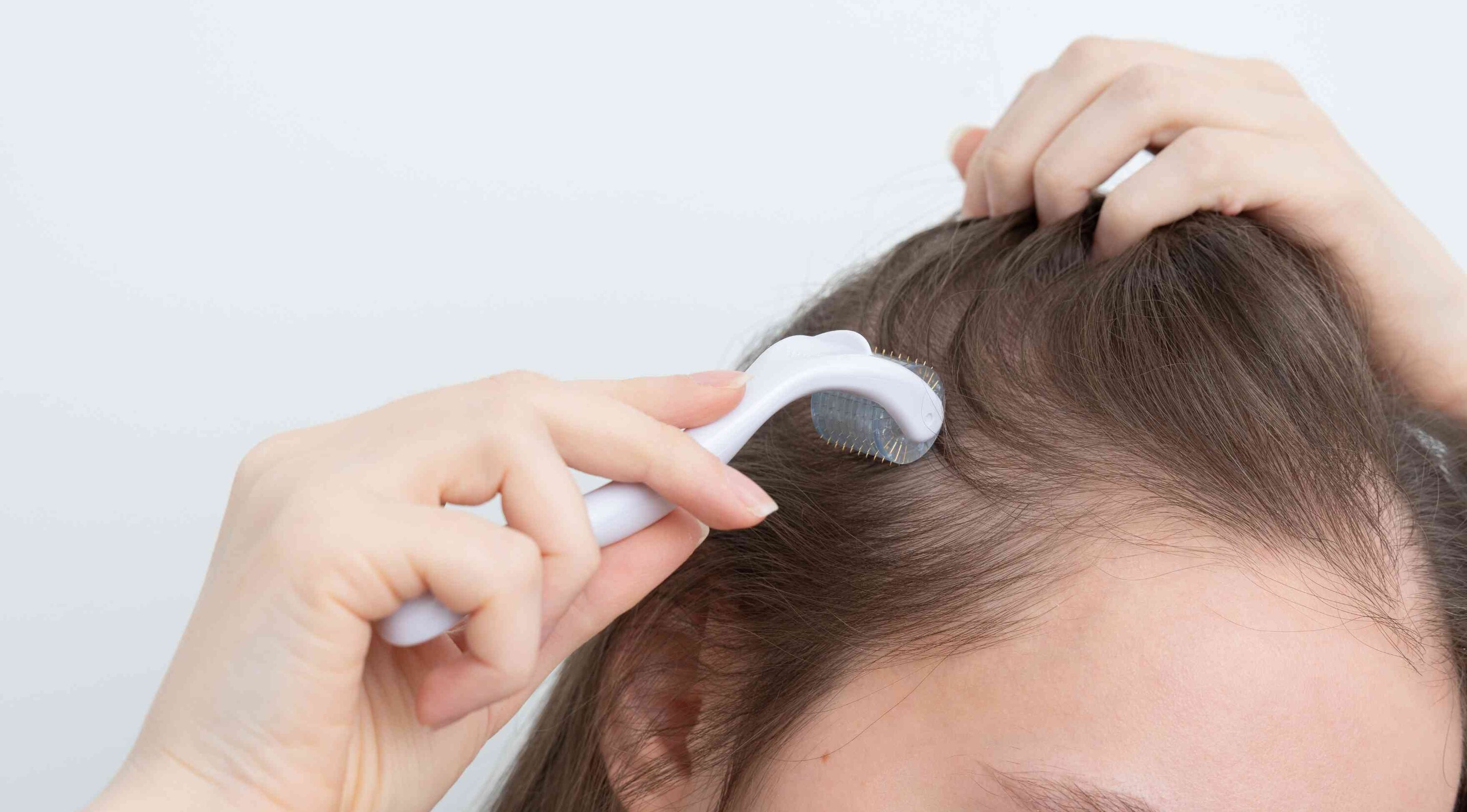 What Is a Derma Roller for Hair Image