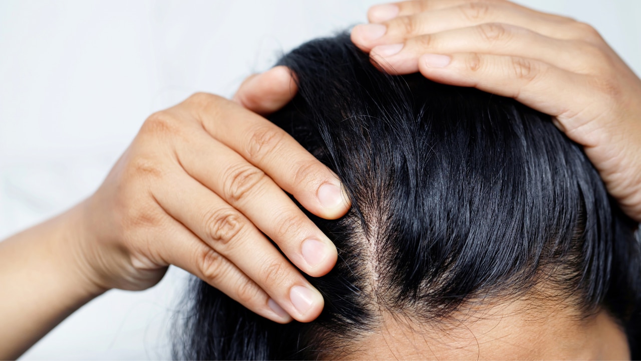 Balances Scalp Oil Production