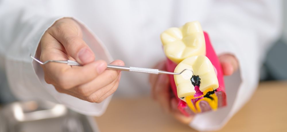 cara menghilangkan ngilu pada gigi berlubang