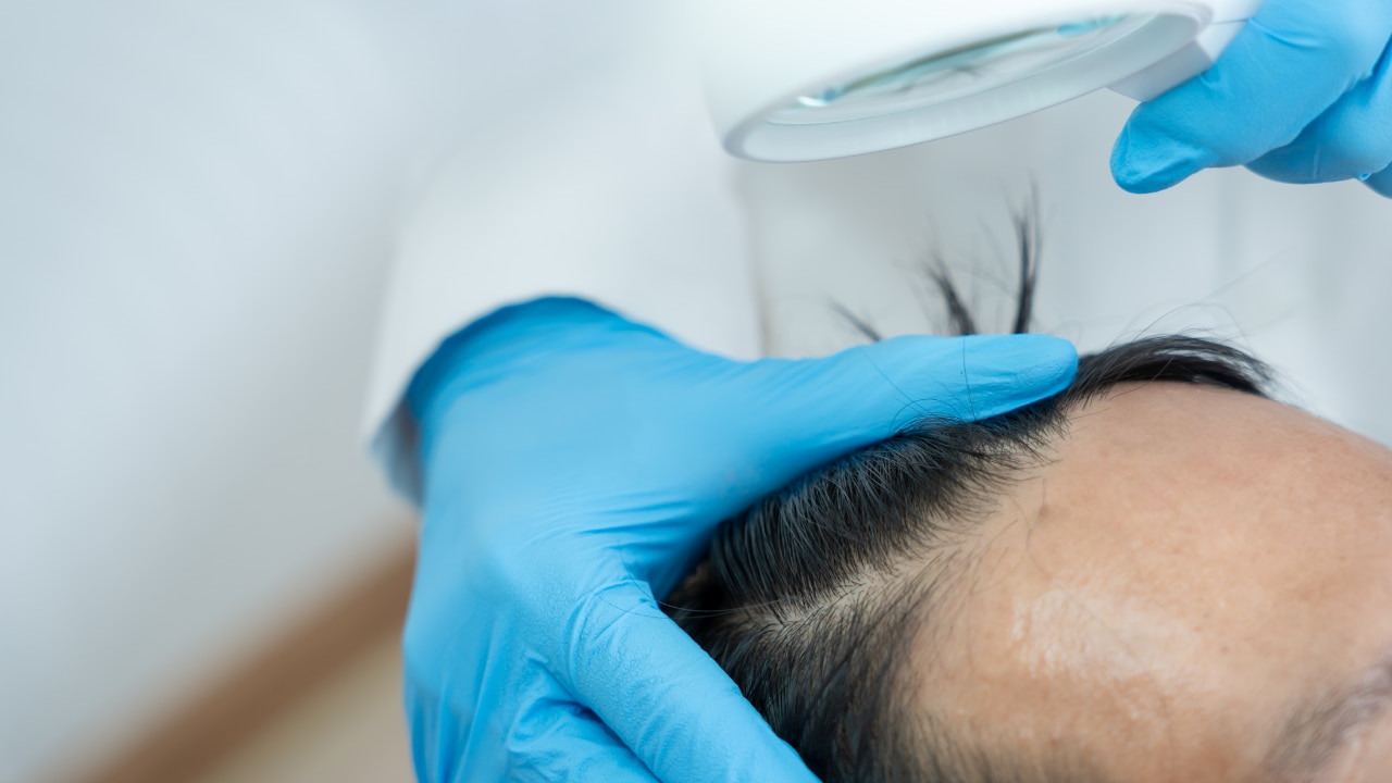 Biotin Benefits for Hair Growth