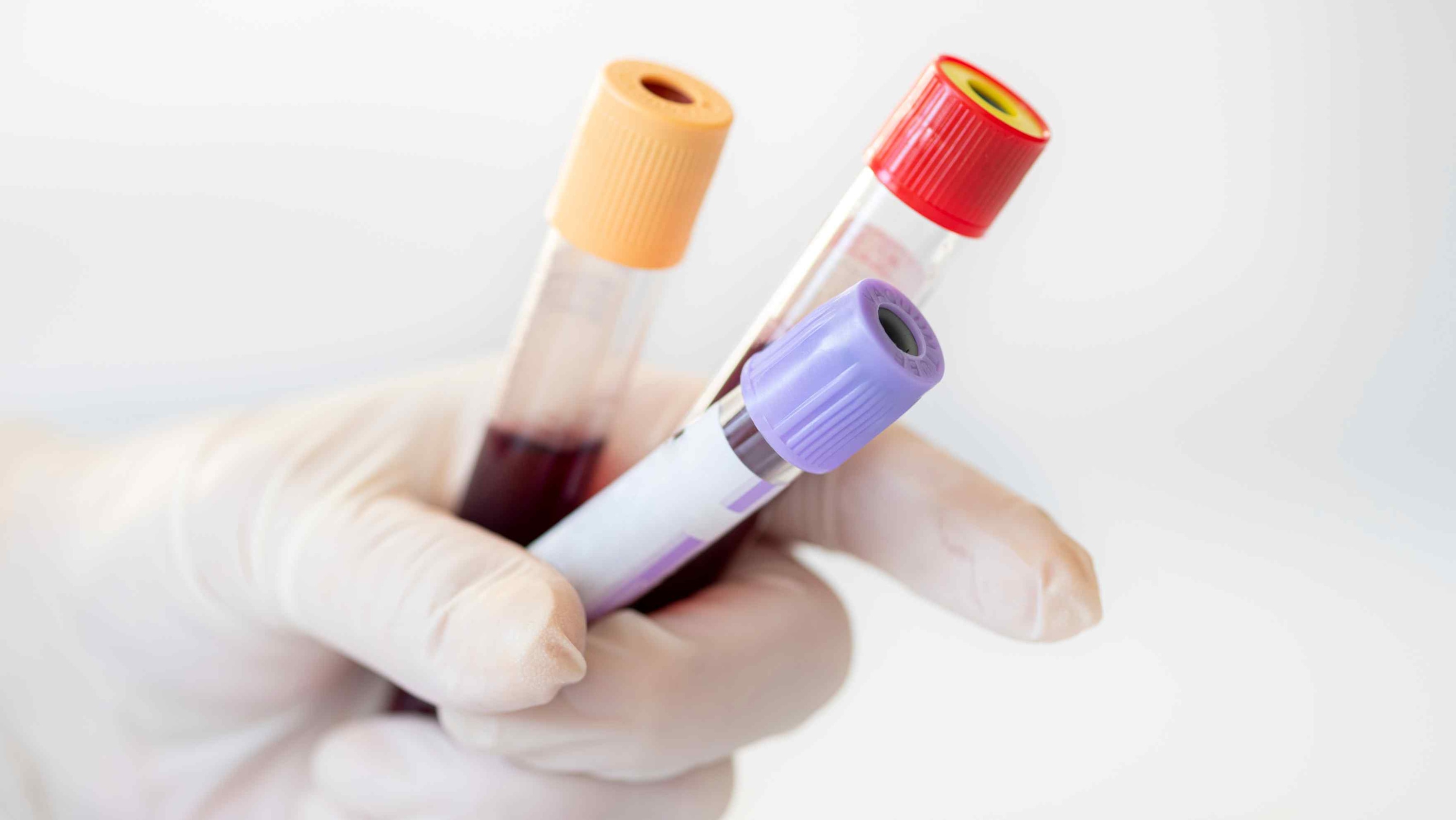 Blood Thinning Effects
