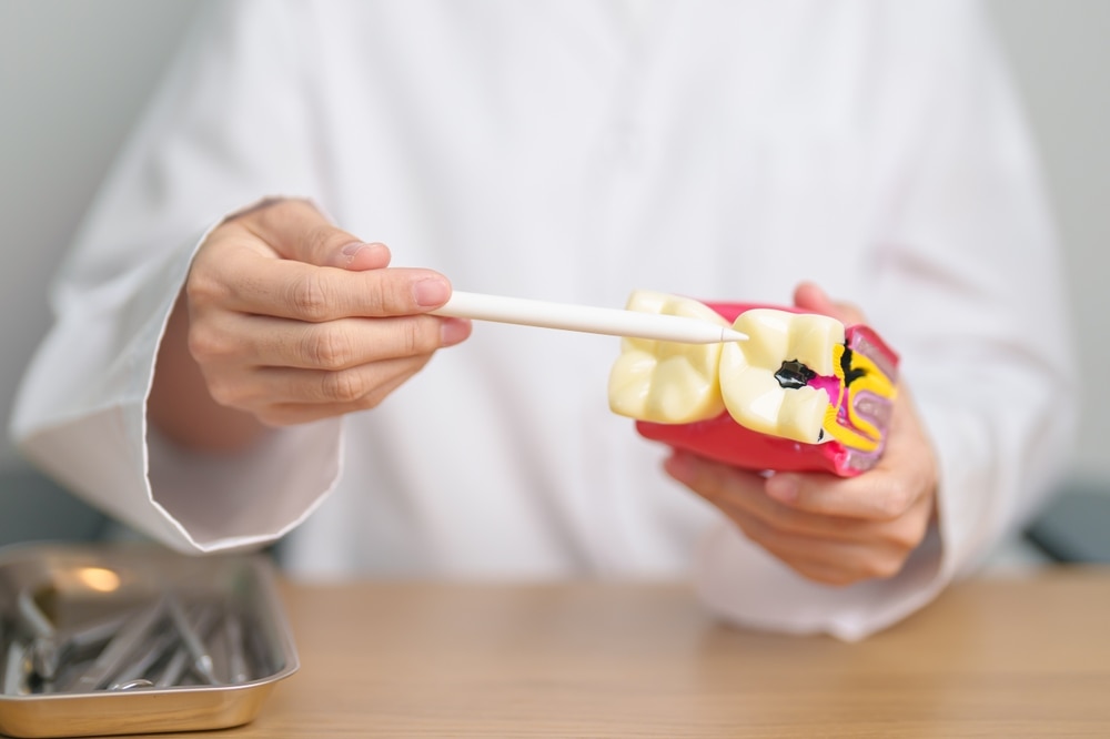 saraf gigi berlubang