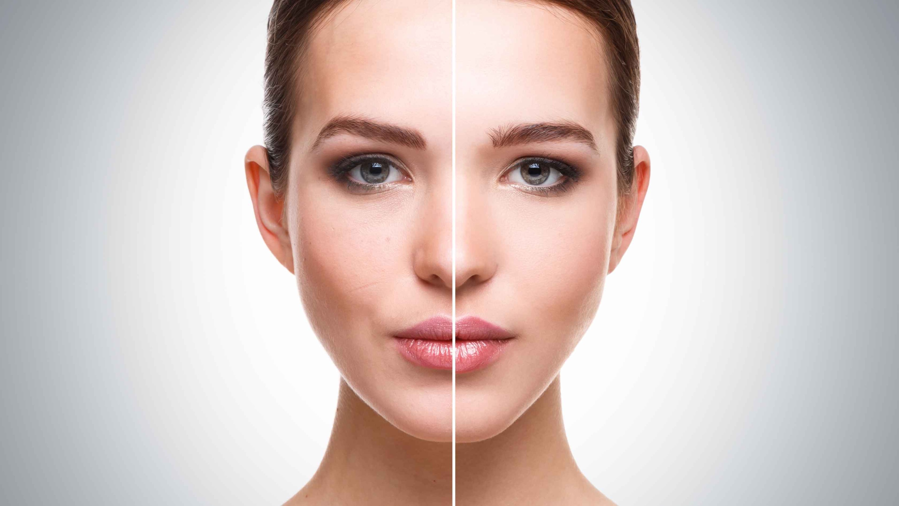 Hydrafacial Before and After -
