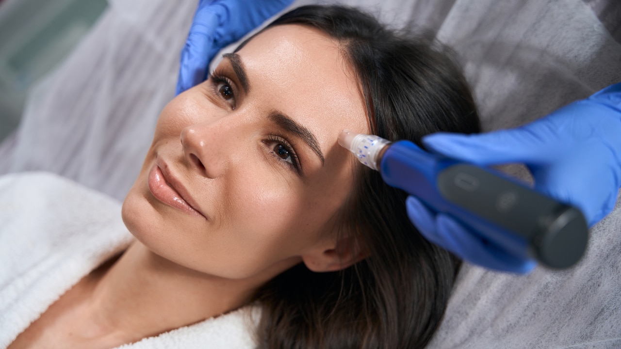 How Does Microneedling Work? (Step by Step Process)