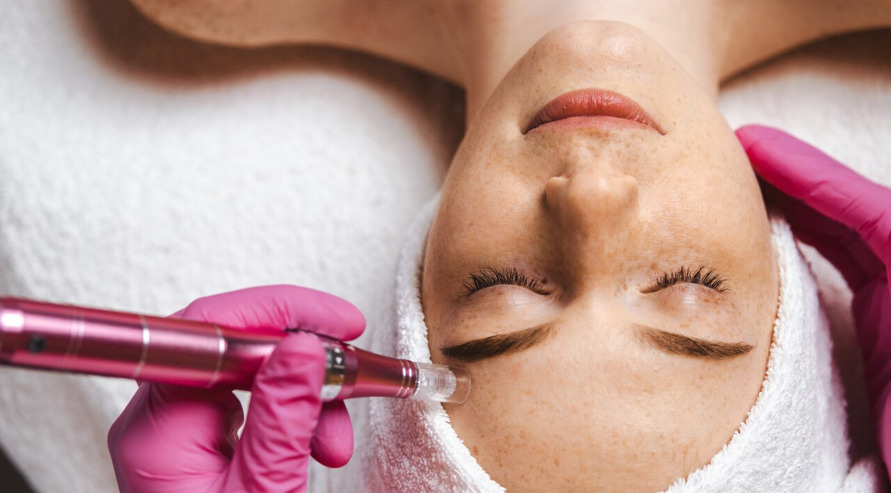 Microneedling Benefits for Skin