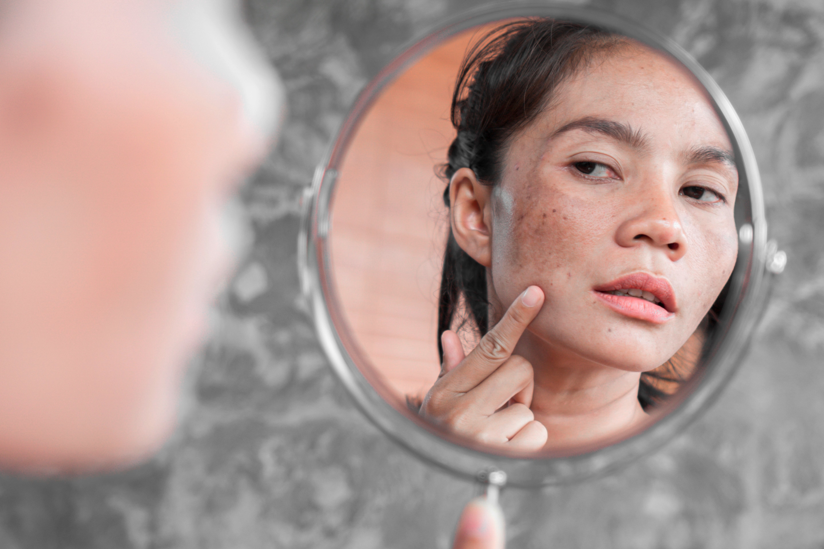 Woman checking her skin in front of a mirror.