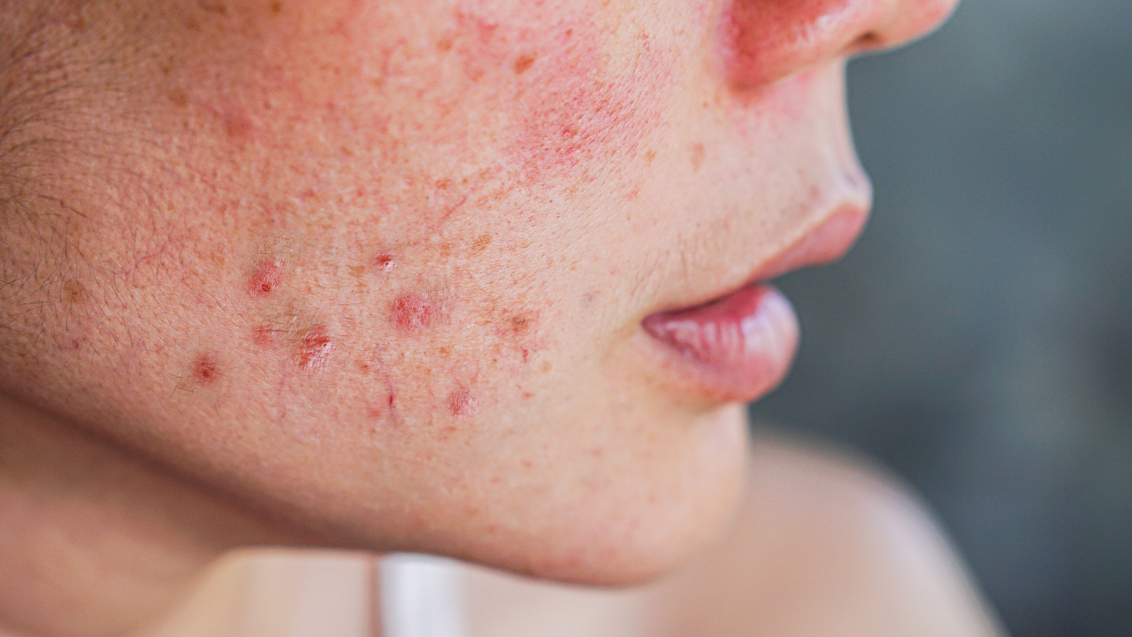 For Sensitive Skin: