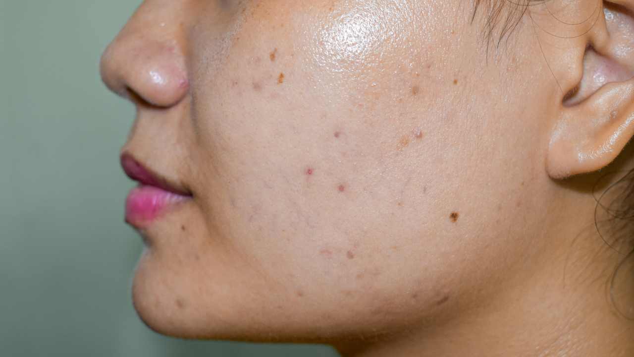 Prevents dullness and dark spots: