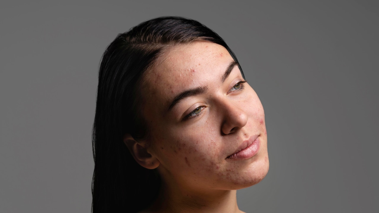 Skin barrier is weaker in winter: