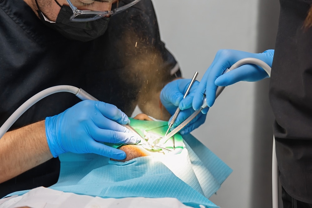 cara mencabut gigi berlubang