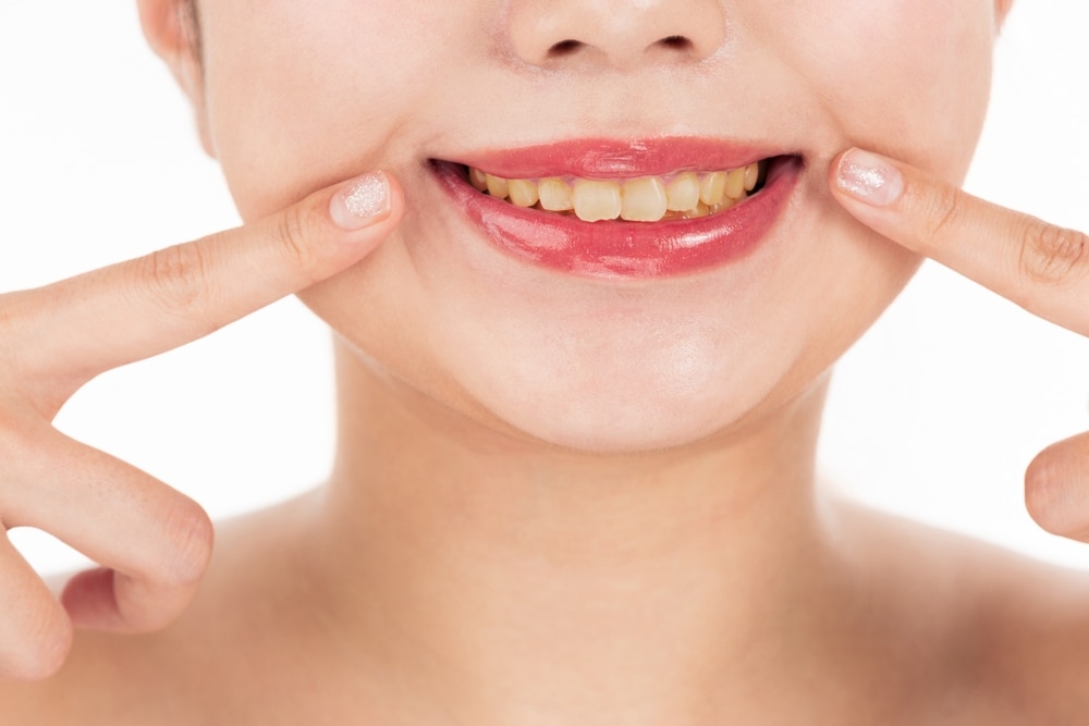 gigi kuning pada ibu hamil