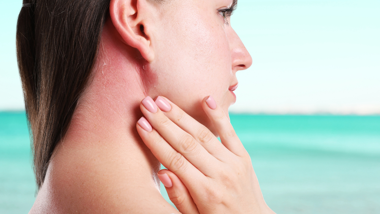 Sensitive Skin Type