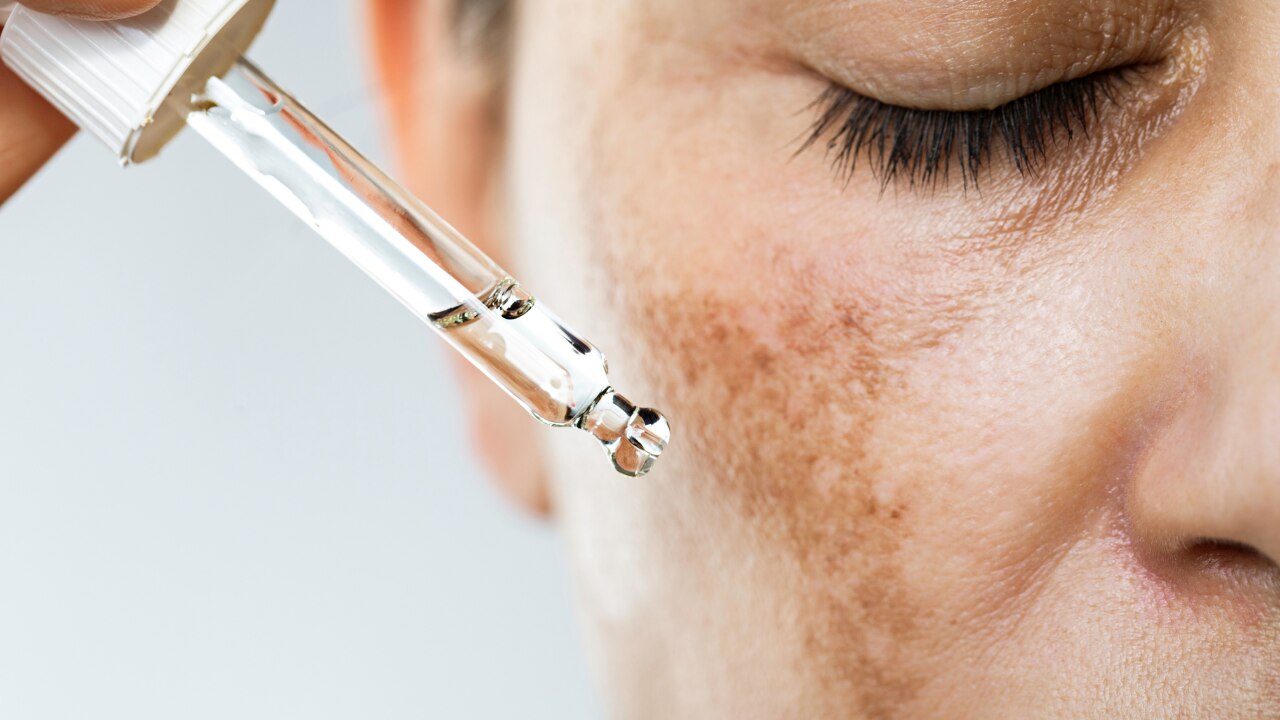 Target Scars with AHAs: