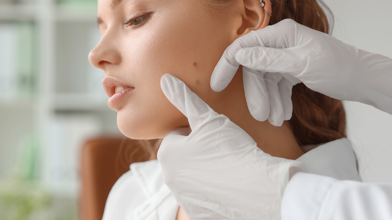 When to See a Dermatologist