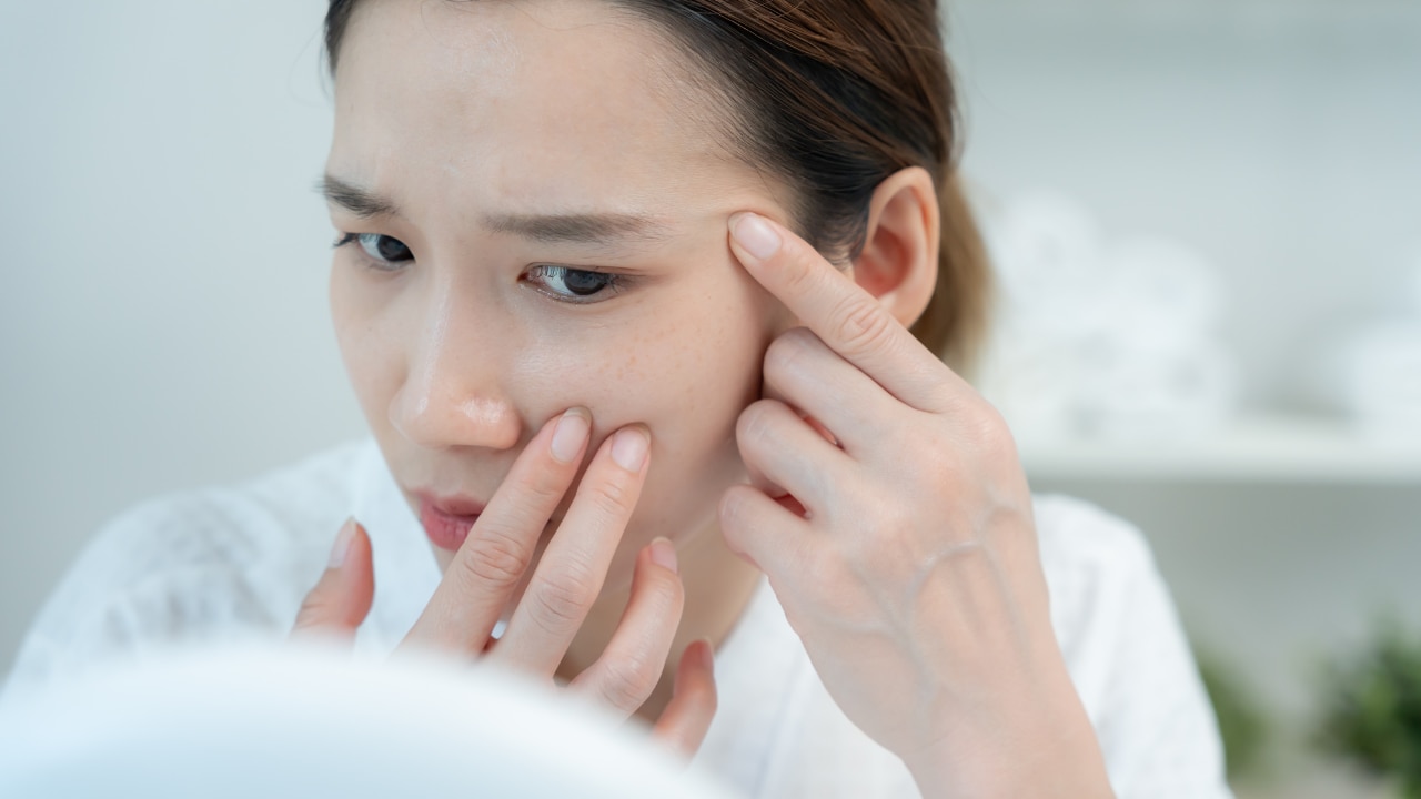 Genetics and Certain Skin Conditions: