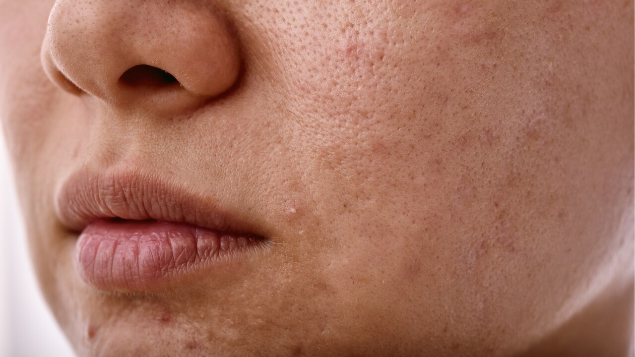 Skin Trauma