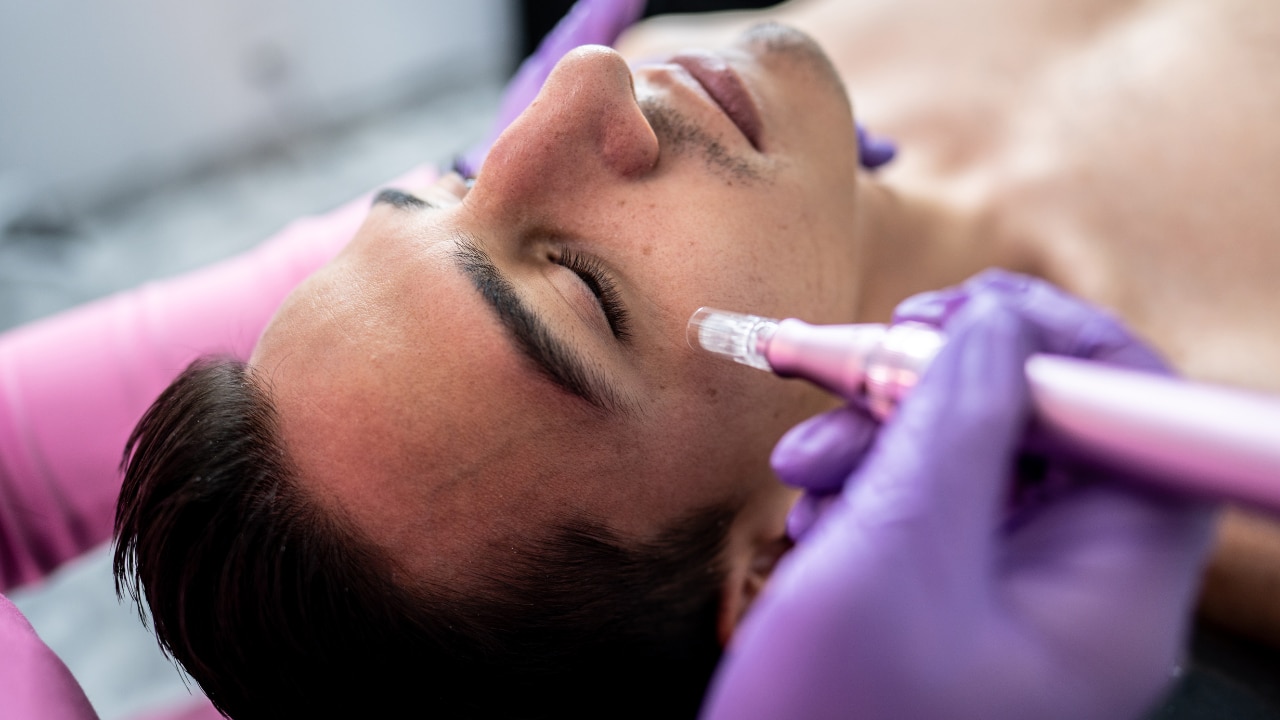 De-roofing/Extraction: