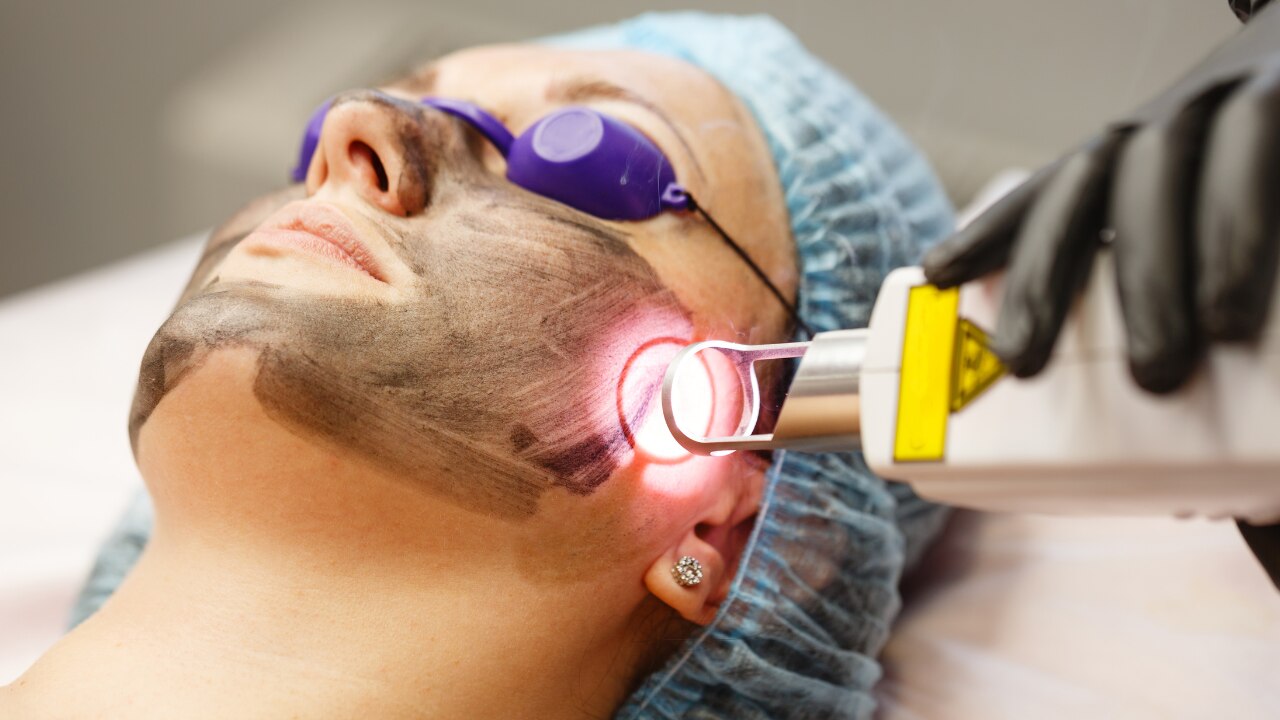 Laser Ablation
