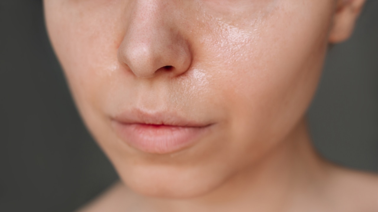 Avoid Heavy, Greasy Moisturisers on Affected Areas: