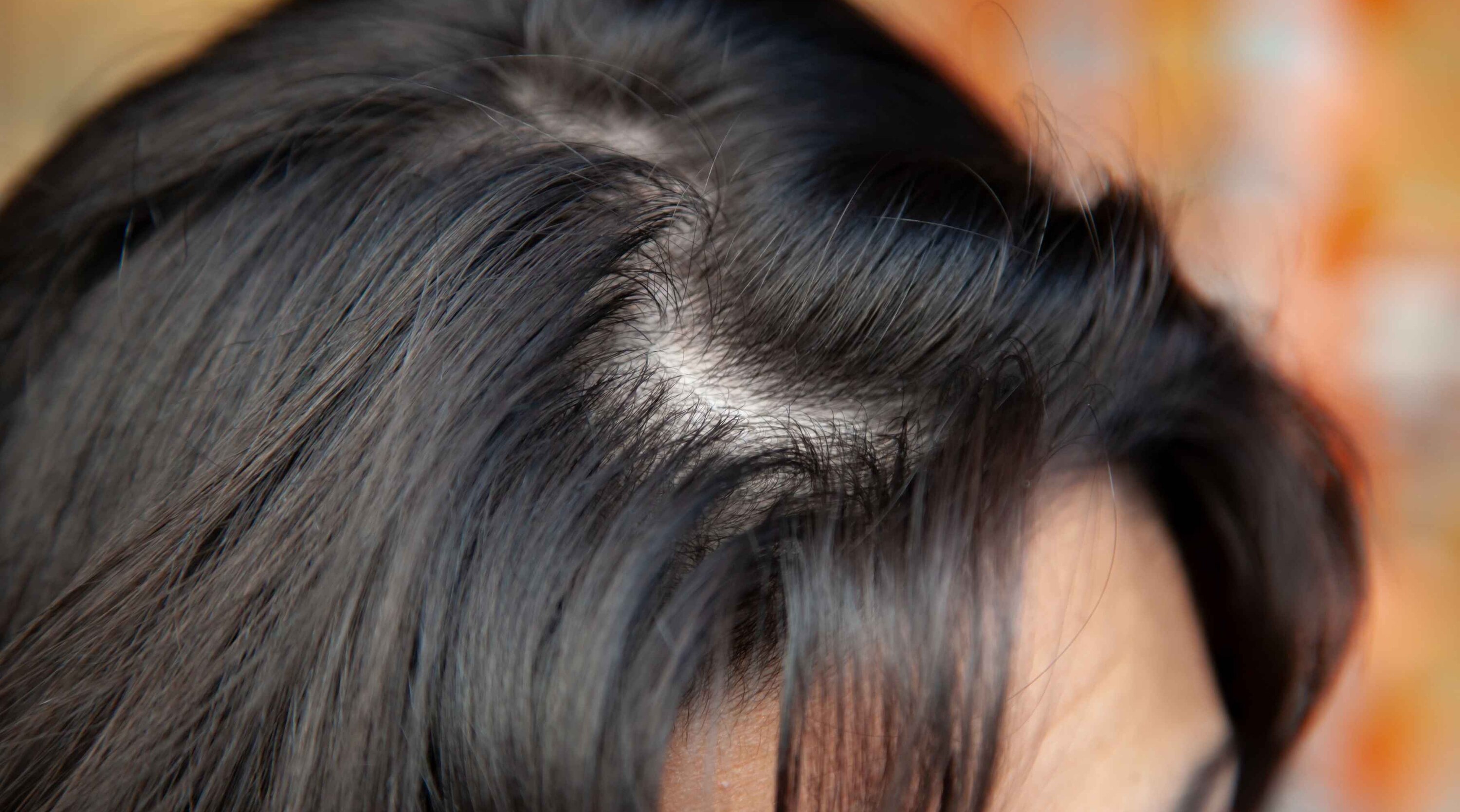 Tips to Manage and Prevent Greasy Hair