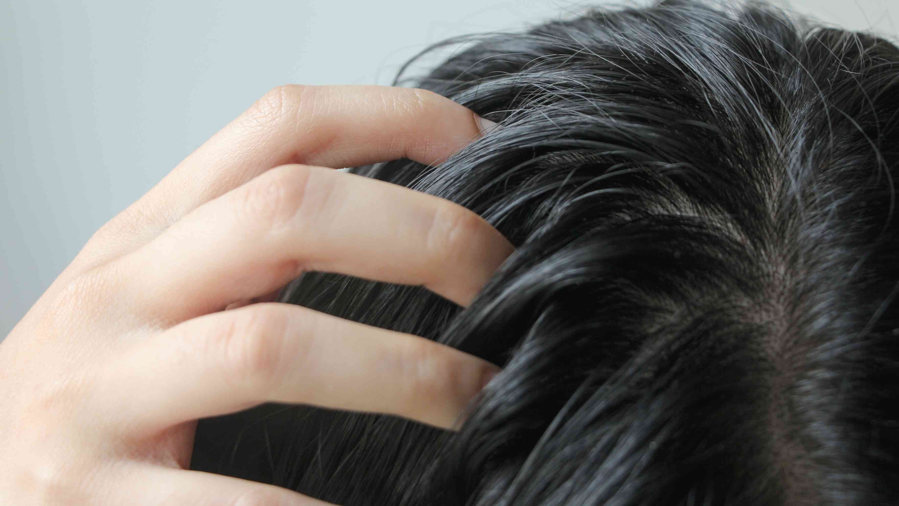 Greasy Hair vs. Oily Scalp — What’s the Difference?