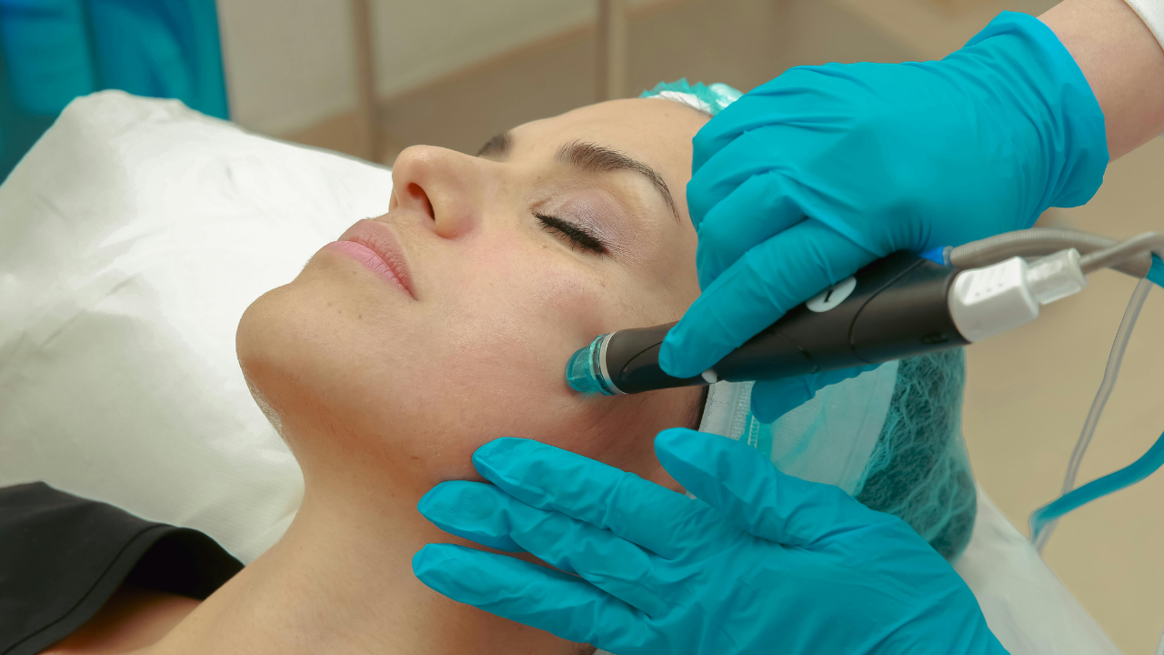 Professional & Medical Treatments for White Spots on Face