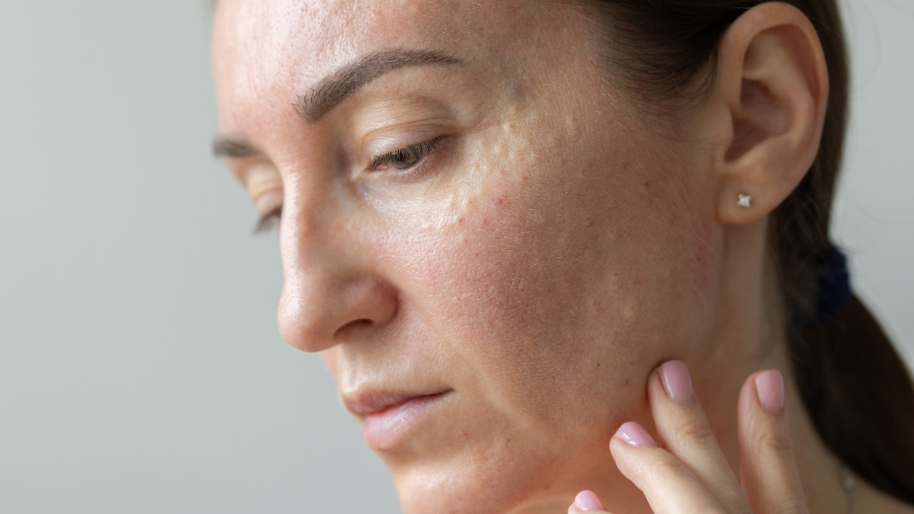 Treat Underlying Inflammation: