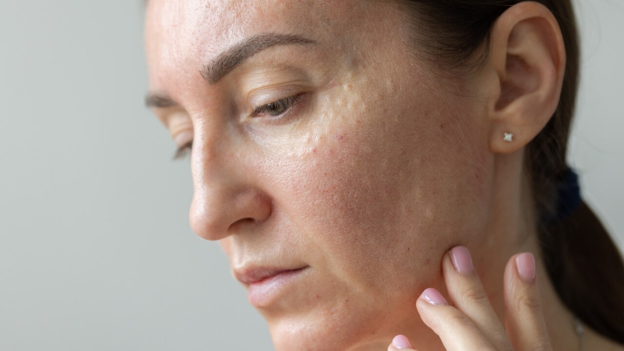 Treat Underlying Inflammation: