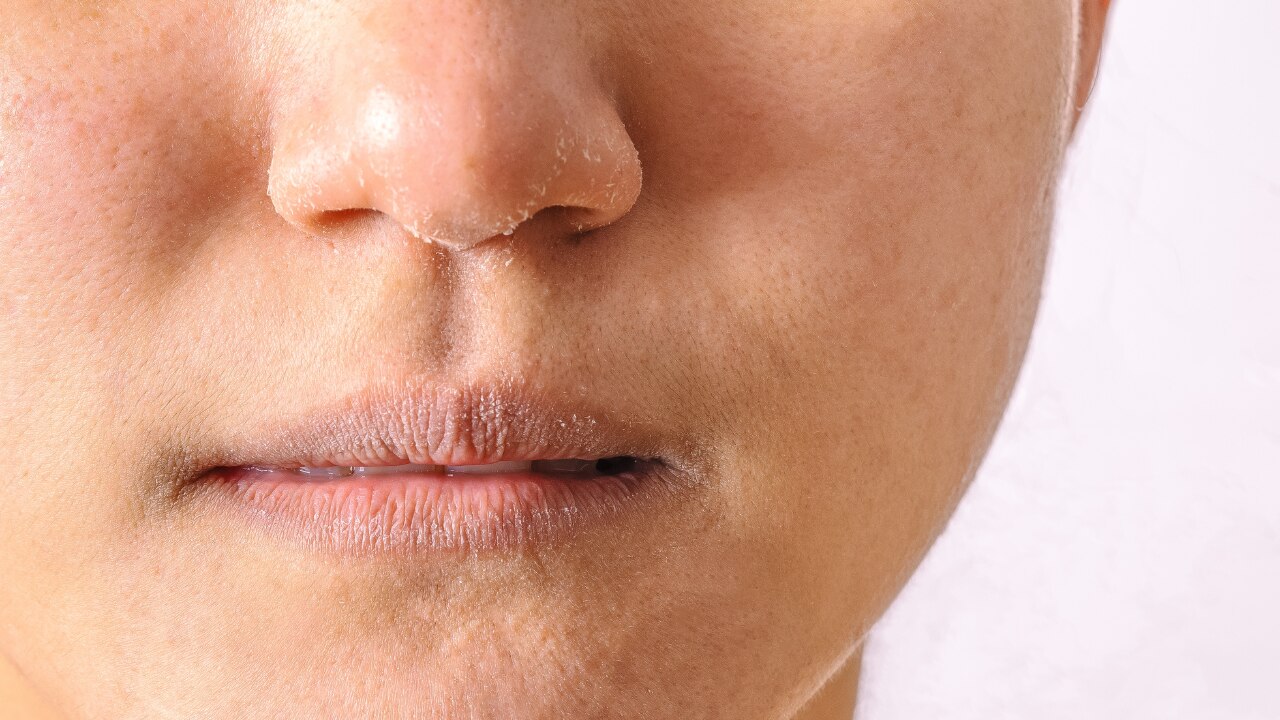 Deeply Moisturises Dry Skin: