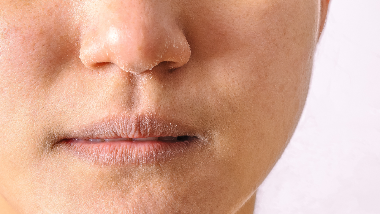 Deeply Moisturises Dry Skin: