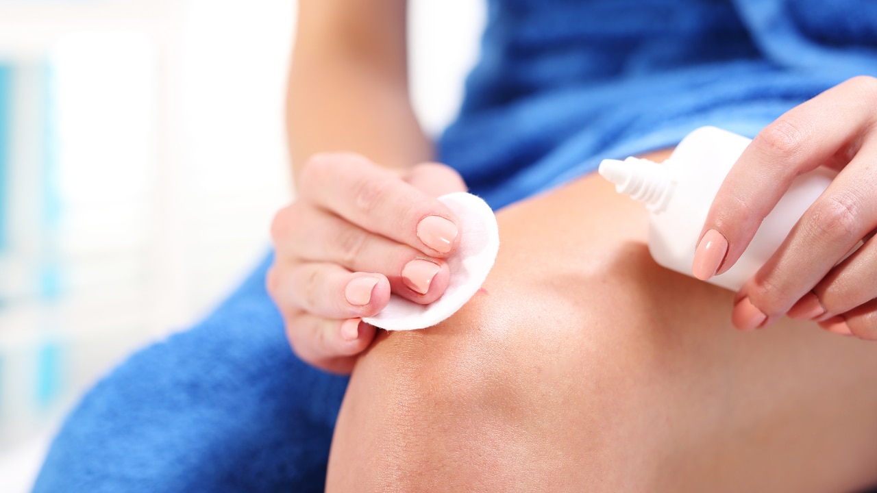 Heals Minor Wounds and Scars