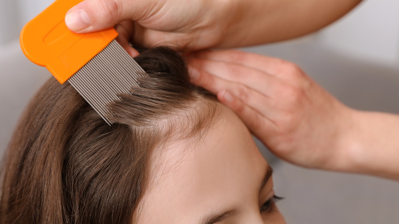 Natural Head Lice Treatment