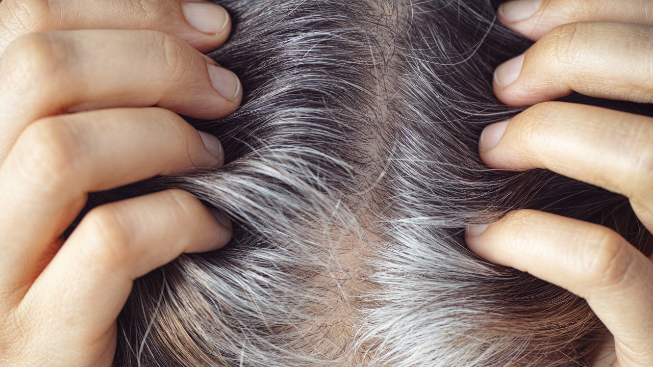 Prevents Premature Greying