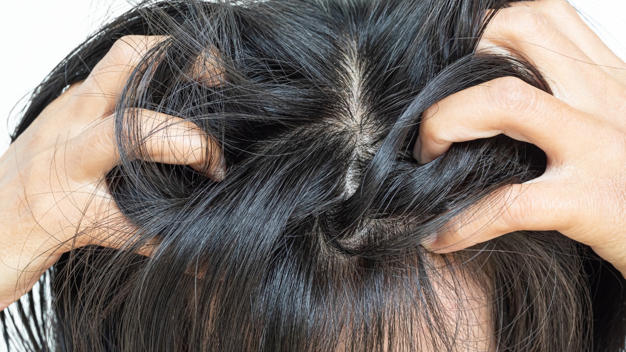 Soothes Scalp Irritation: