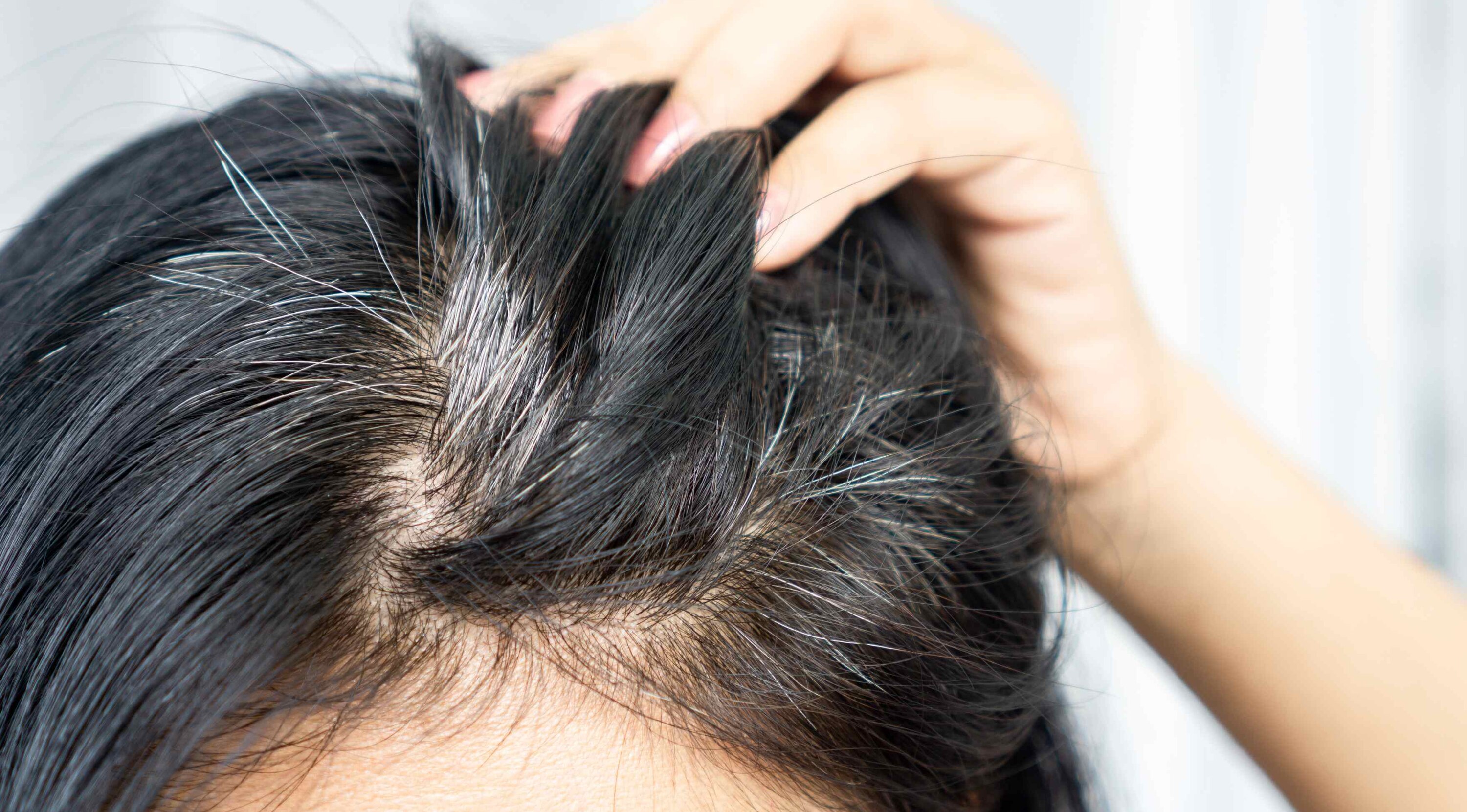 Prevents Premature Greying