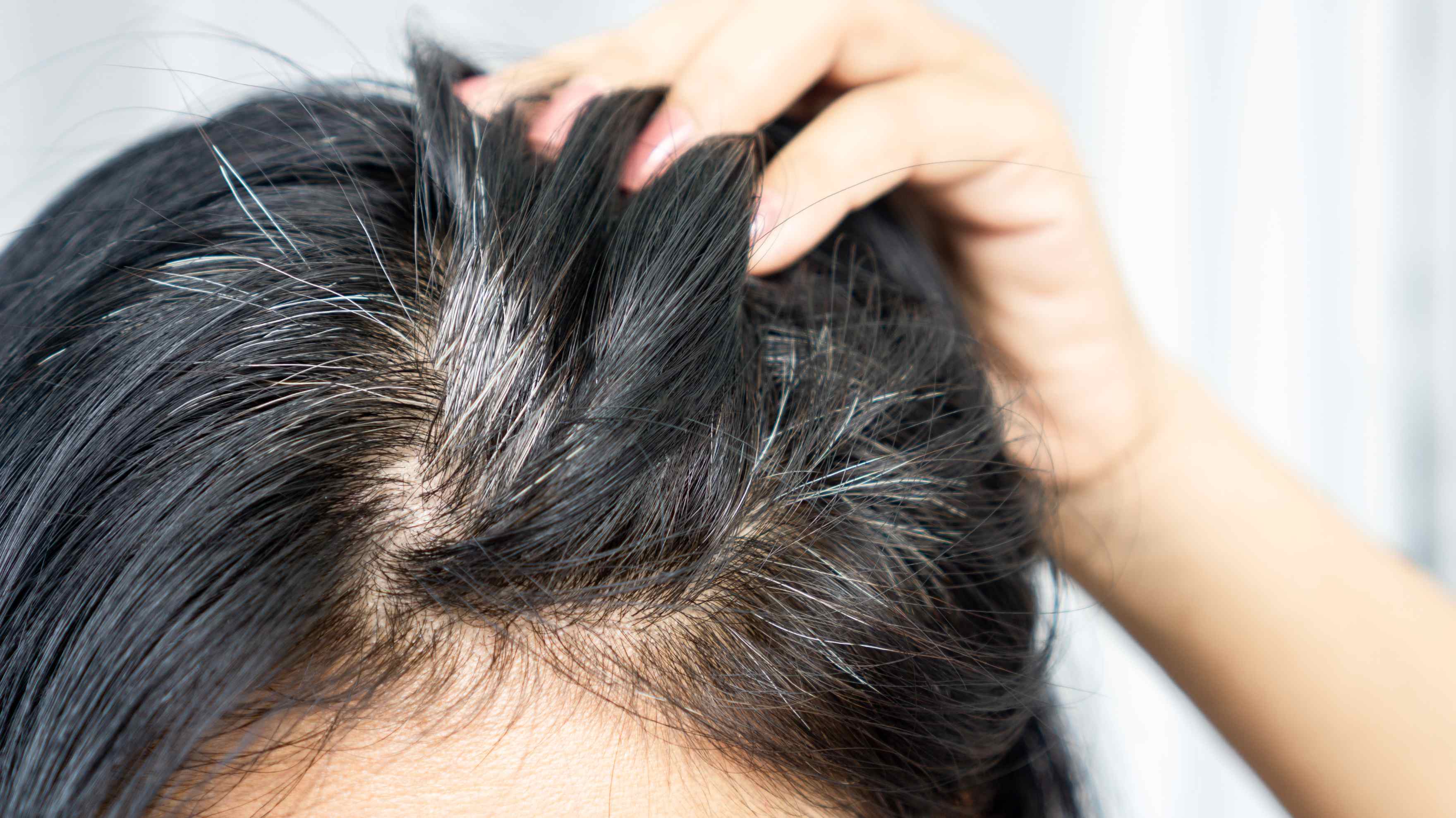 Prevents Premature Greying